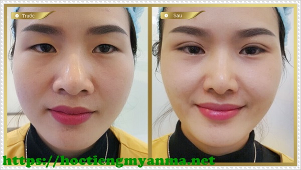 bấm m&iacute; h&agrave;n quốc
