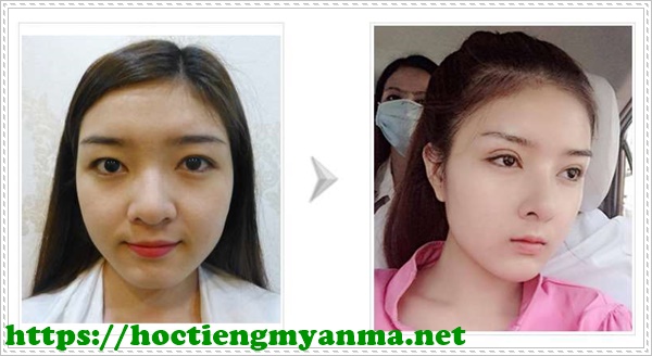 Bấm m&iacute; H&agrave;n Quốc gi&uacute;p đ&ocirc;i mắt trở n&ecirc;n sắc sảo, r&otilde; n&eacute;t